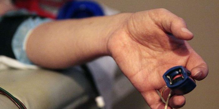 Explaining Sudden Cardiac Death in Male Minority Athletes