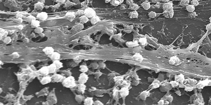 $1.57 Million Grant to Combat Hospital-Acquired Infections