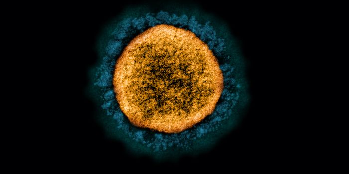 The Genetics Underlying Susceptibility to Severe COVID-19