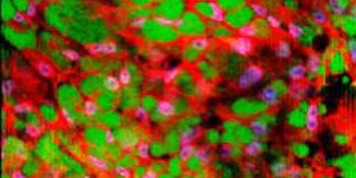 Changing White Fat to Brown Fat