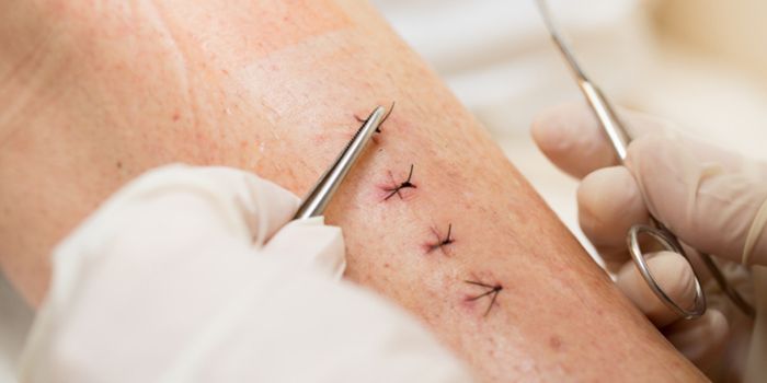 Tufts Scientists Invent ‘Smart' Sutures for the OR