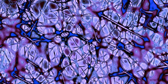 A Common Denominator Among All Forms of ALS is Revealed