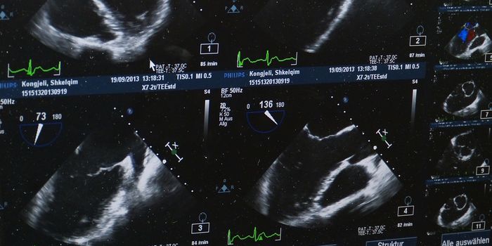 Making Pregnancy Safer with a New Method for Monitoring the Fetal Heartbeat
