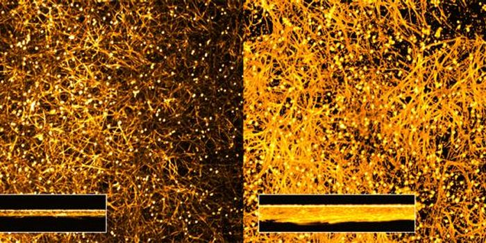 How a Human Protein Helps Turn a Fungus Into a Pathogen