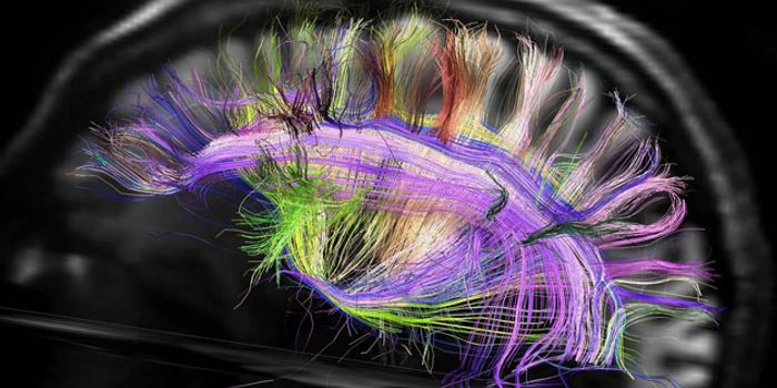 DIA Patient Fellows Illustrate the Power of the Patient in Drug Development