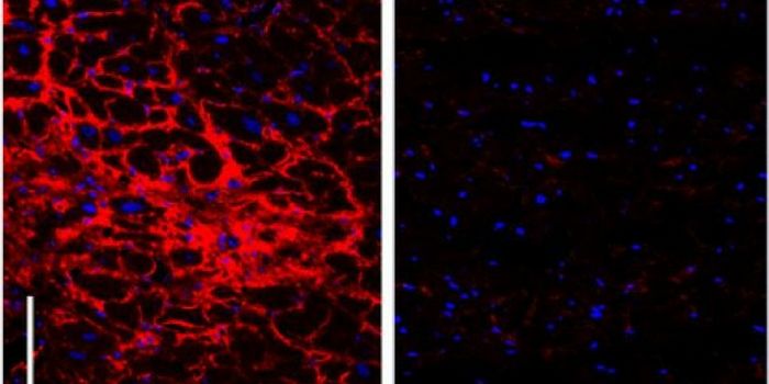 Molecular "Nets" within the Heart Lead to Organ Failure