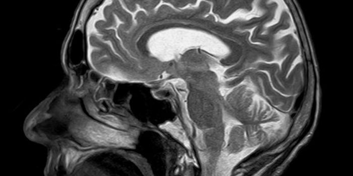 Can A Brain Injury Increase Alzheimer's Risk?