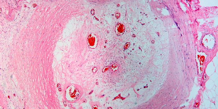 Scientists Create Long-lasting "Repair Caulk" for Blood Vessels