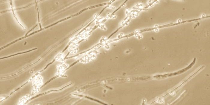 This Toxin Helps Candida Yeast Maintain a Competitive Edge in the Gut