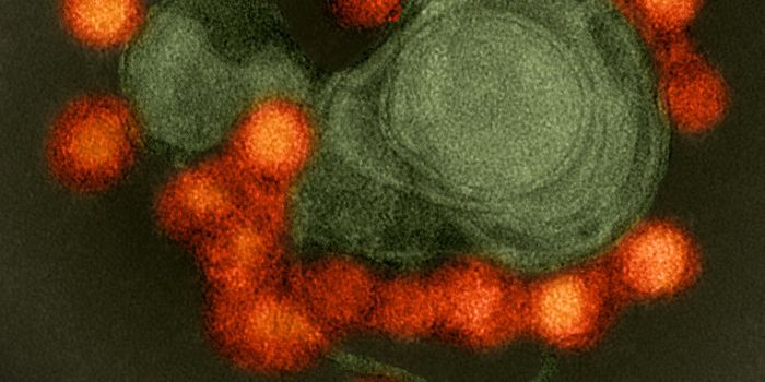 Previous Zika Infections Increase the Risk of Severe Dengue