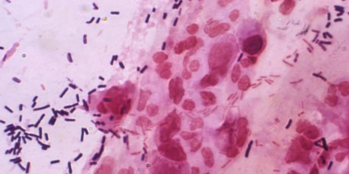 Miscarriages May be Linked to Vaginal Microbes