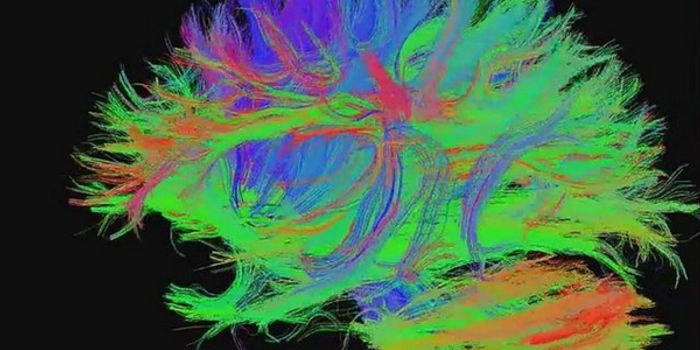 Mapping The Infant Brain to Track Development