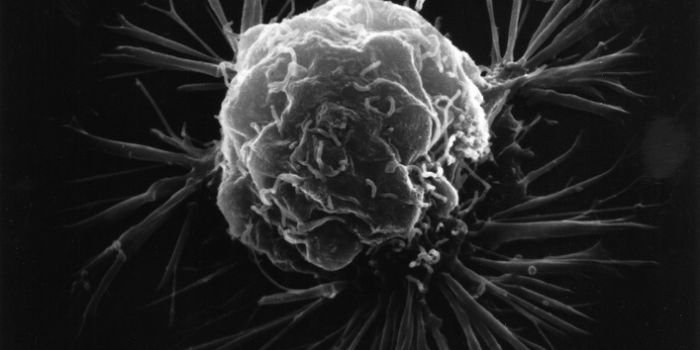 20 Cancer Facts You Should Know