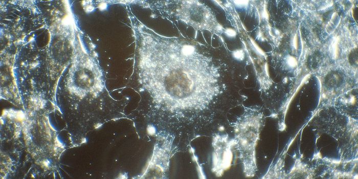 Temporarily Muting Immune Regulation Focuses Attention on Cancer