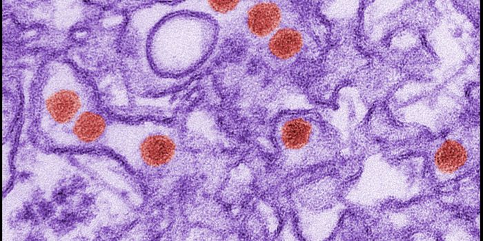 Can Zika Virus Help Neuroblastoma Patients?