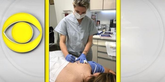 Tips for Reducing Your Melanoma Risk