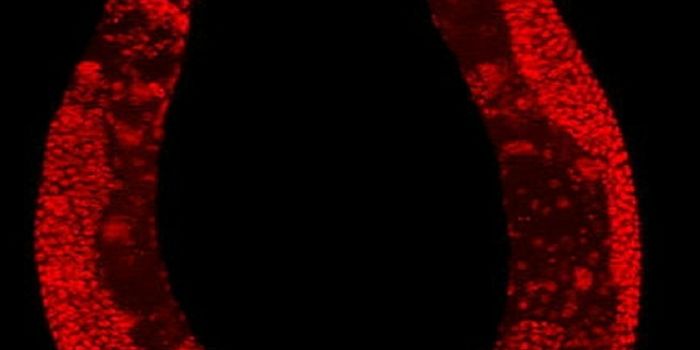 Visualizing Anxiety in the Brain