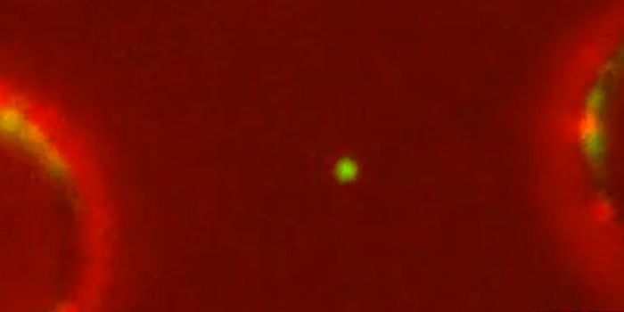 Insight Into a DNA Damage Sensor That Orchestrates Repair