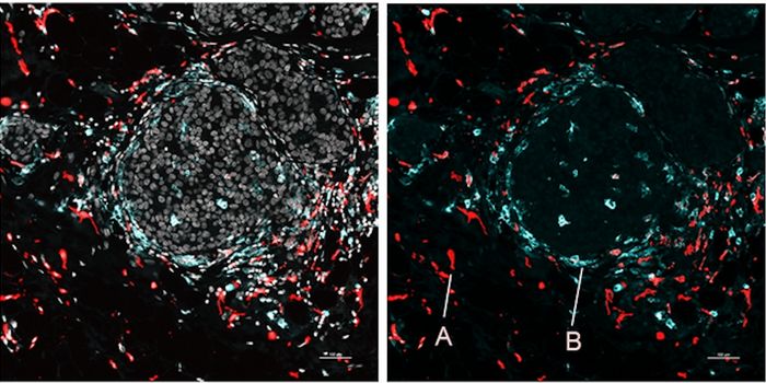 Pinpointing the Location of Gene Expression in Various Tissues