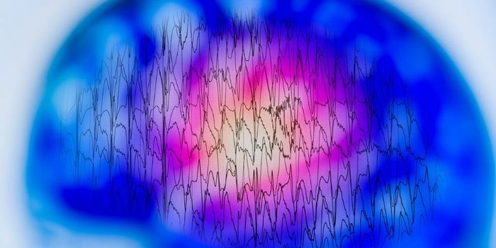 Drug Seeks To Target Treatment-Resistant Epilepsy