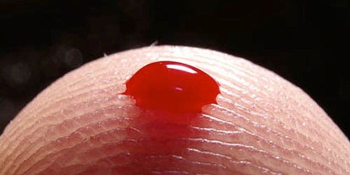 More Trouble For Theranos: Study Finds A Drop is Not Enough