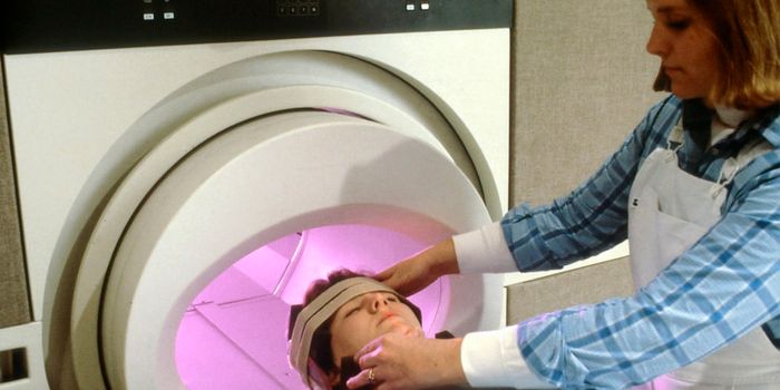 AI Framework Identifies Early Signs of Alzheimer's