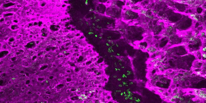 Understanding Why a Skull Suture May Close Too Soon