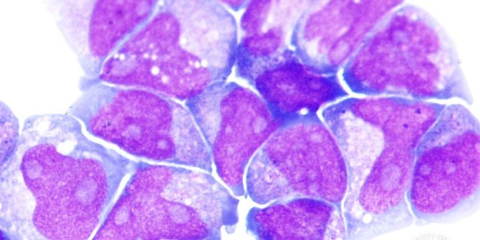 New Immunotherapy Prevents Relapse for Leukemia Survivors