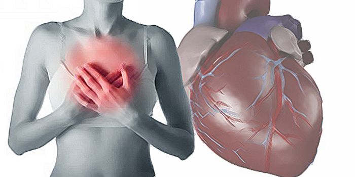 Chronic Inflammation, Free Radicals, and Coronary Heart Disease