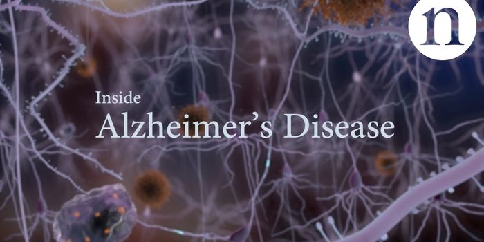 A Visualization of Alzheimer's on the Molecular Level
