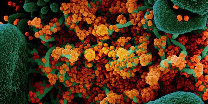 Antibodies Isolated From COVID-19 Patients Show Therapeutic Potential