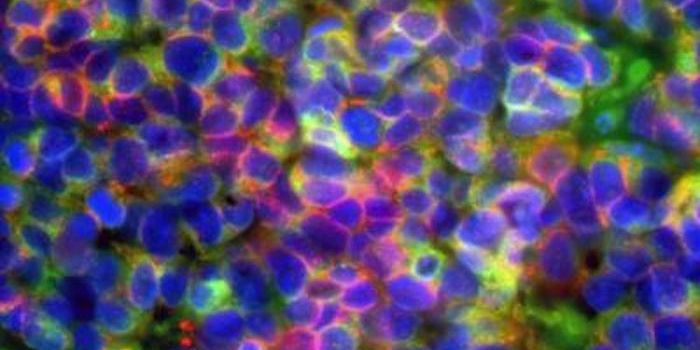 Similar Processes Drive the Development of Lung and Prostate Cancers