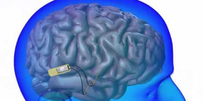 DARPA's New Brain Device