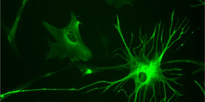 Characterizing the Link Between Epilepsy and Brain Tumors