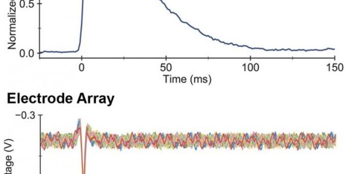 Noninvasive Technology Detects Neural Activity