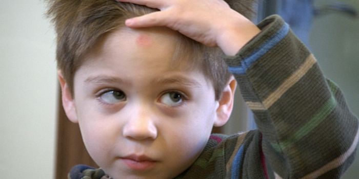 Does Race Impact Treatment of Brain Injuries?