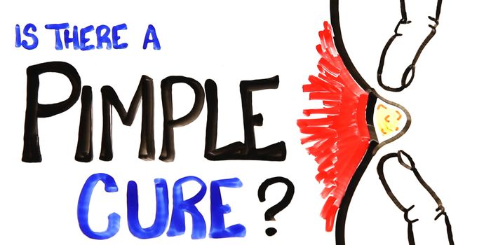 The Science Behind Pimples