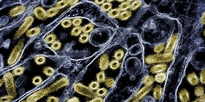 Bird Flu Spreads to Dairy Cows & Is Detected in Raw Milk