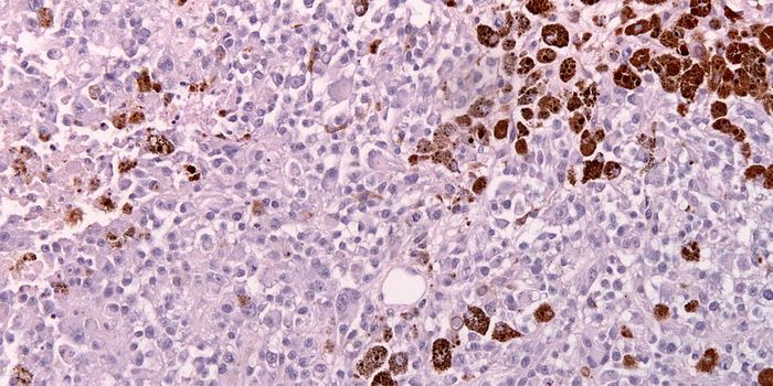 "Runx3" Protein Directs Killer Cells to Set Up Camp in Tumors