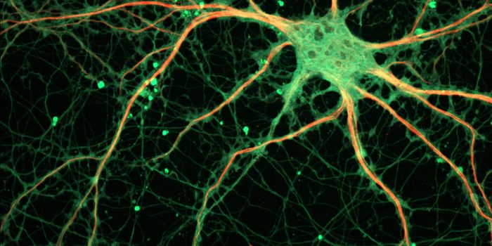 T Cells Aggravate Parkinson's Disease
