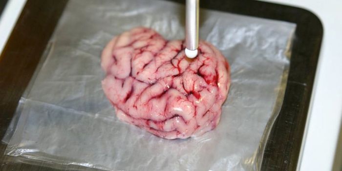 Next-Gen ‘Smart Scalpel' Can Locate Cancer in The Brain