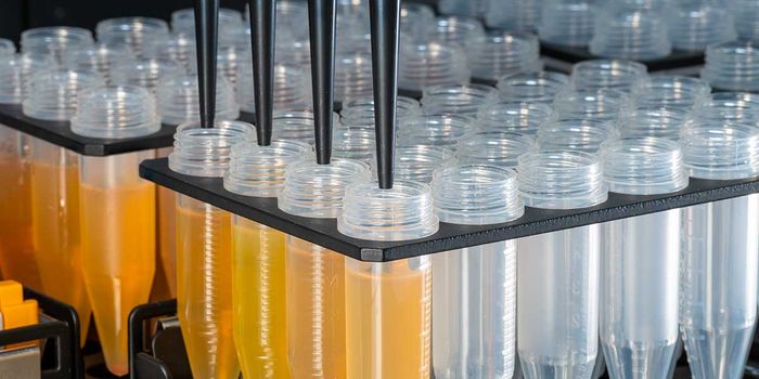 Tips on Establishing a Reliable Cell Free DNA Workflow