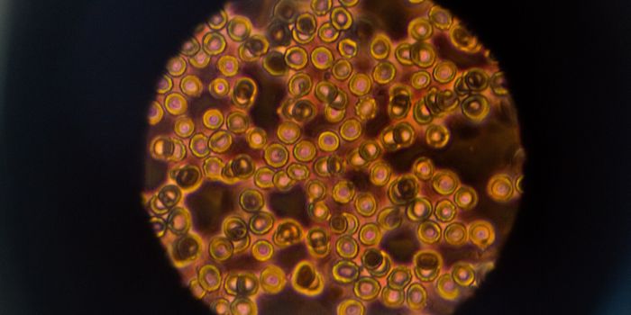 Cancer Cell Clusters Better At Resisting the Immune System