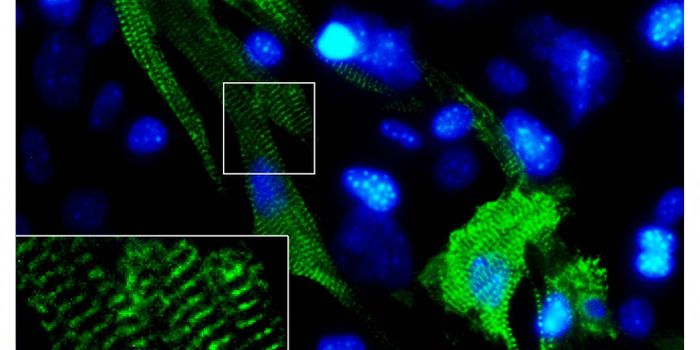 You've Had A Heart Attack. Now What?