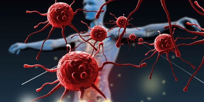 Moving Away from Chemo: New Approach to Cancer Immunotherapy