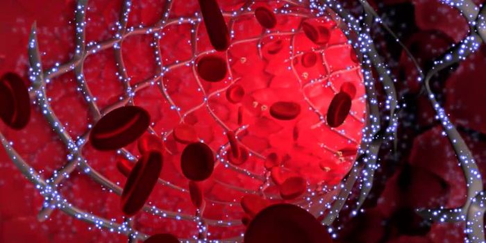 Drug-Eluting Stents Are Just As Effective As Open-Heart Surgery