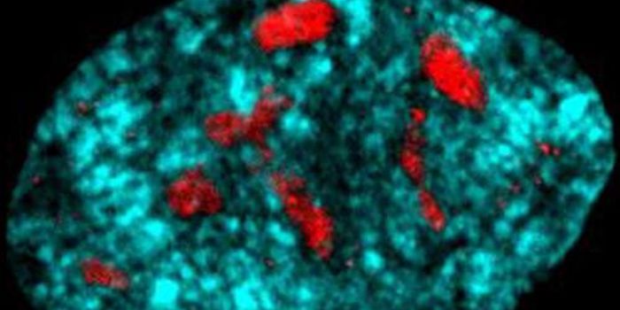 Preventing Aging by Protecting Ribosomes