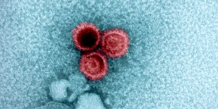 A Potential Approach to Halt the Serious Complications of Epstein-Barr Virus