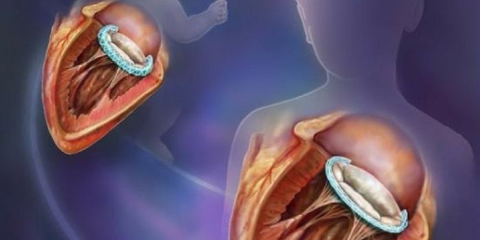 New Device to Fix Heart Defects Grows As the Baby Grows