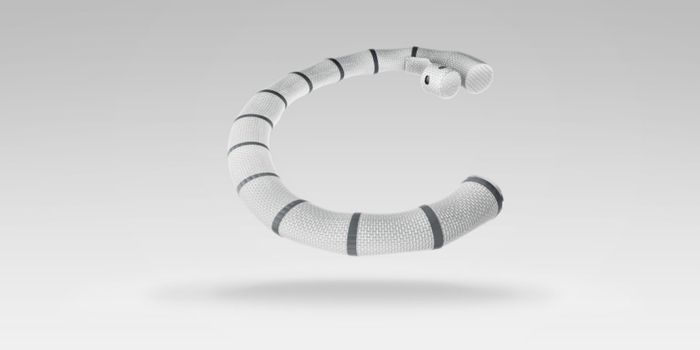 New Catheter Technology Mends Leaky Tricuspid Valve